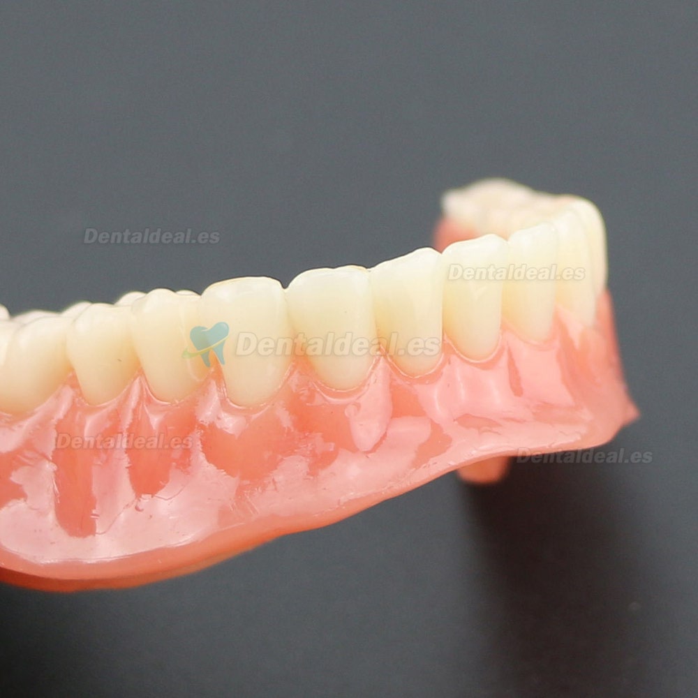 Dientes inferiores dental Modelo de sobredentadura 4 implantes Demostración Modelo 6002 02